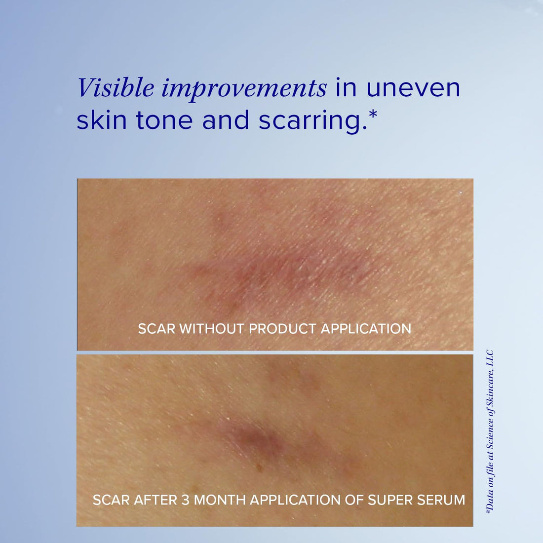iS CLINICAL Super Serum Advance+, 1 fl. oz