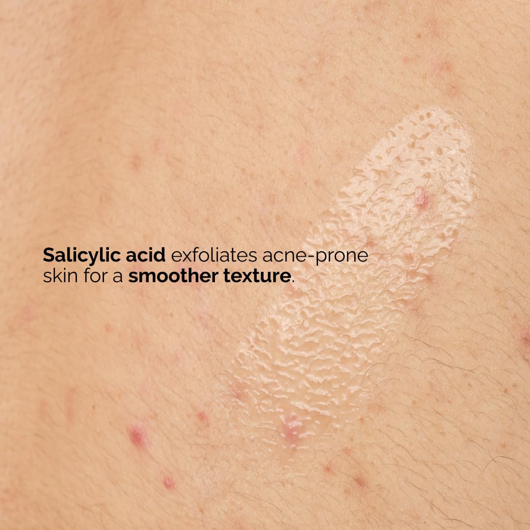 The Ordinary Salicylic Acid 0.5% Body Serum, Exfoliating Treatment for Acne-Prone Skin, 8.1 Fl Oz