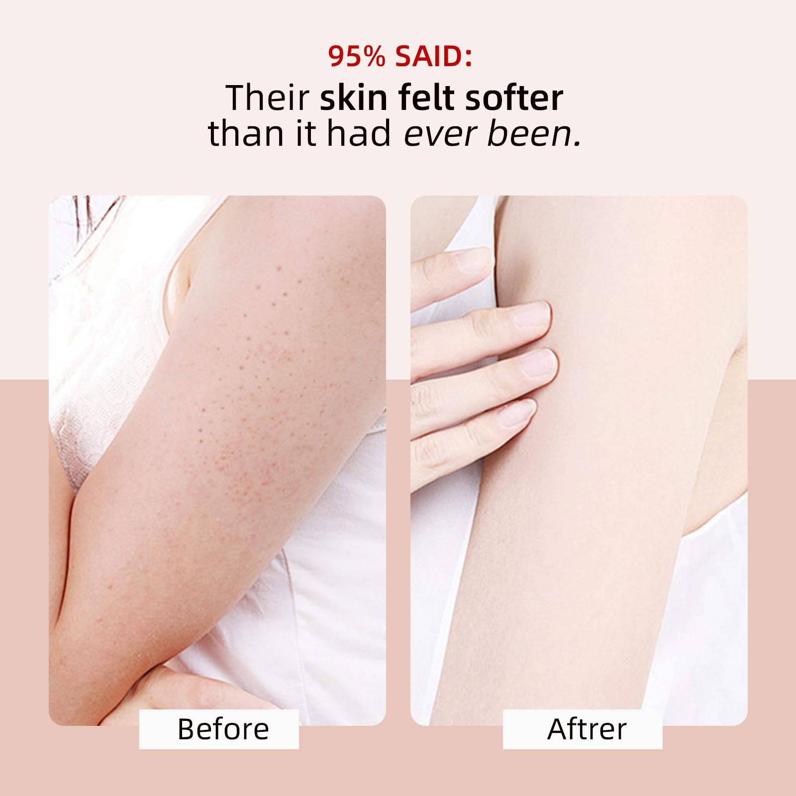 KP Bump Eraser Body Scrub with 10% AHA BHA Ingrown Hair Keratosis Pilaris Razor Bump Treatment Exfoliating Body Scrub Exfoliator Exfoliant Face Scrubs for Strawberry Leg Pre-shaven Blackhead 4.23OZ