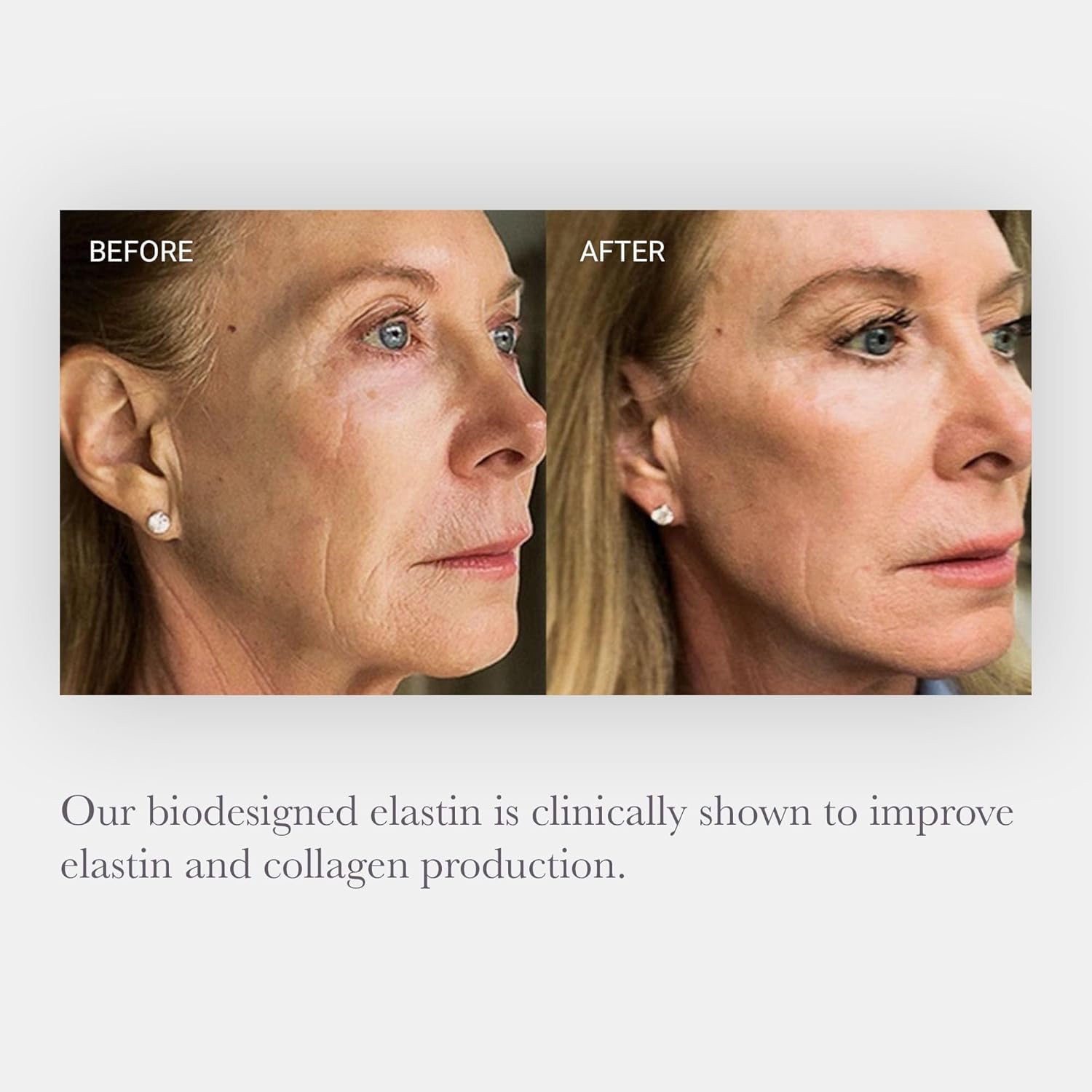 NULASTIN Elastaplex & Hyaluronic Acid Serum for Face, Lips & Décolleté - SKIN Intensive Hydrating Serum - Promote Dewy Radiance in Aging Skin (0.5 oz)