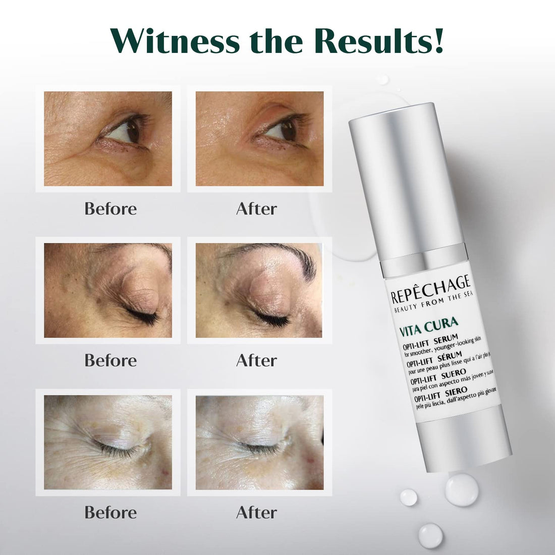 Repechage Eye Opti Serum Use Around the Eye After Cleansing and Toning. Vita Cura Opti-Lift Face Serum for Appearance Signs of Premature Aging. Smoother, Younger Looking Skin Used Day and Night 15ml.