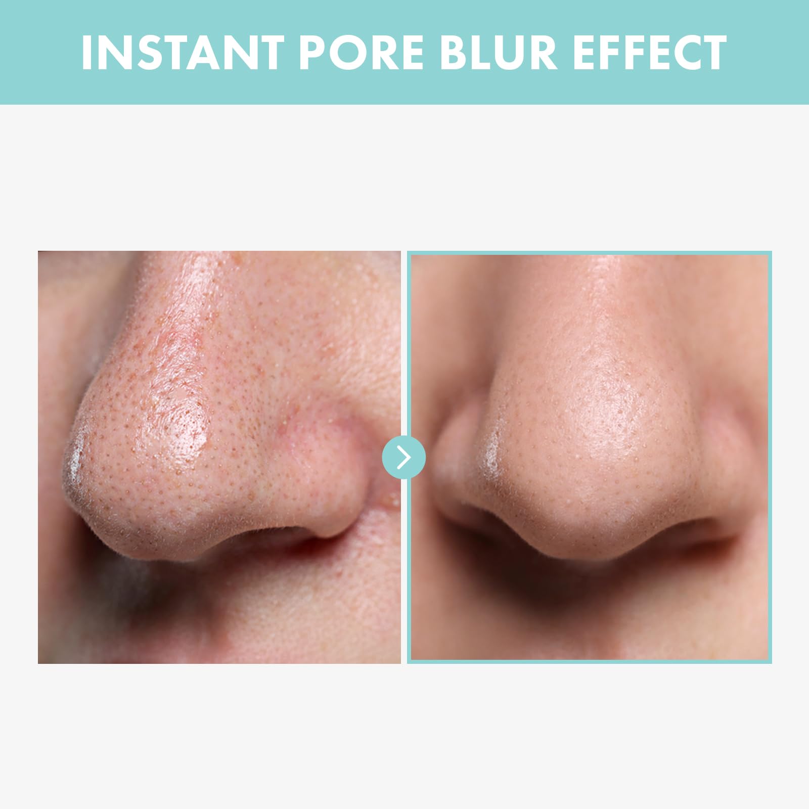 TOSOWOONG Pore Tightening Serum, Instantly Reduces Pores, Smooths Skin & Strengthens Barrier, Formulated With Niacinamide & Allantoin, Pore Minimizer For Face, Korean Skin Care, 30ml, 1.01 fl. oz.