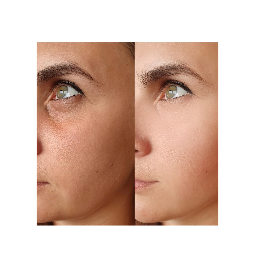 ZAIN1 Snail Mucin Regenerating Face Serum with Hyaluronic Acid and Damascus Rose for Anti-Aging, Hydration and Radiance