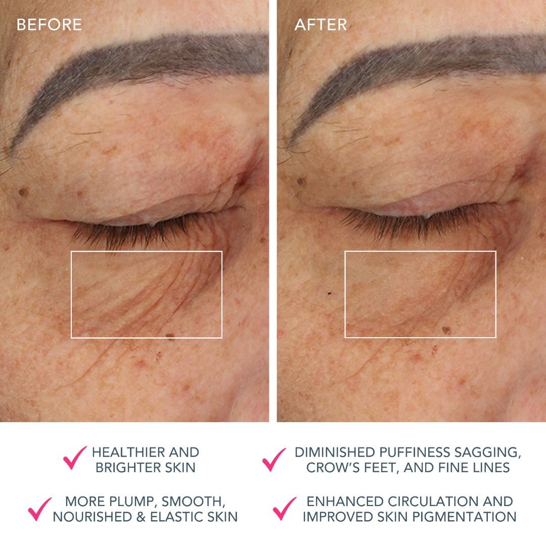 FOREO BEAR App-connected Microcurrent Facial Toning Device with 5 Intensities, Fuchsia