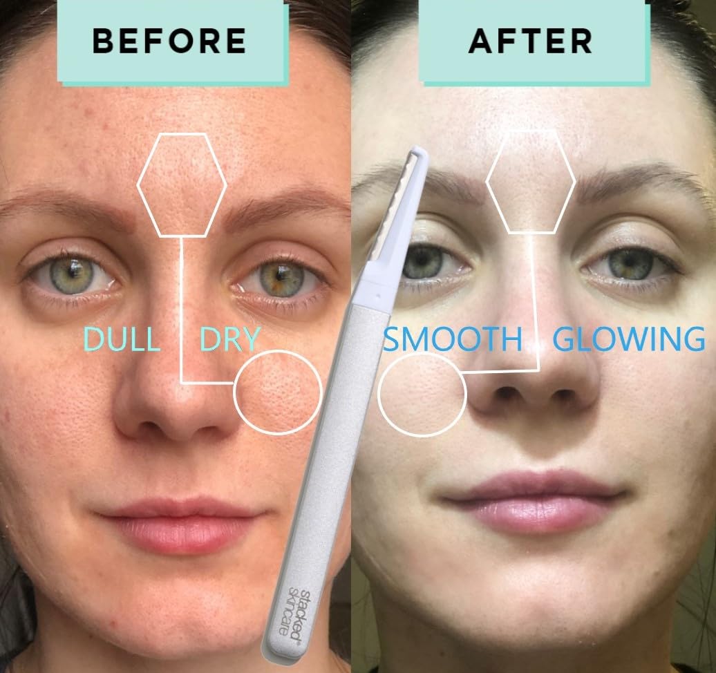StackedSkincare Facial Smooth, Radiant Skin Exfoliating Dermaplaning Tool