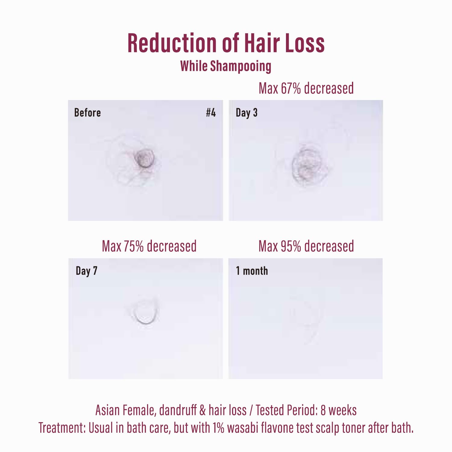 Moist Diane Keratin Shampoo for Hair Loss & Itchy Scalp Men & Women, Organic Shampoo with Argan Oil & Wasabi from Japan, Dry Scalp Solution for Hair Thickening, EXTRA HAIR FALL CONTROL, 15.2 Fl Oz