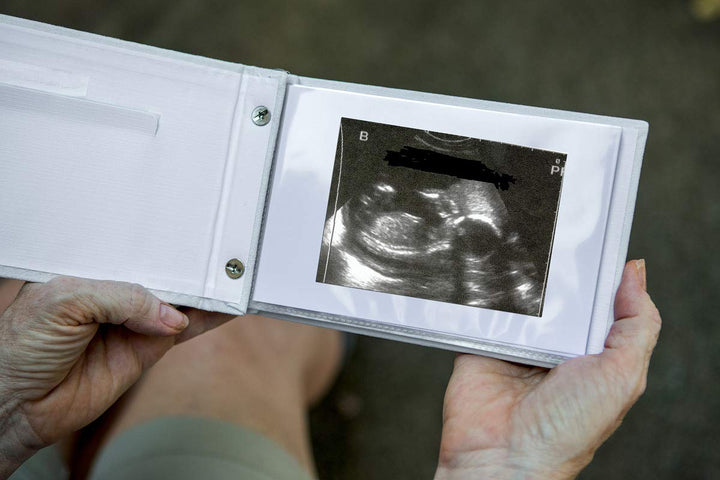 Pregnancy/Maternity Ultrasound And Photo Album/Keepsake
