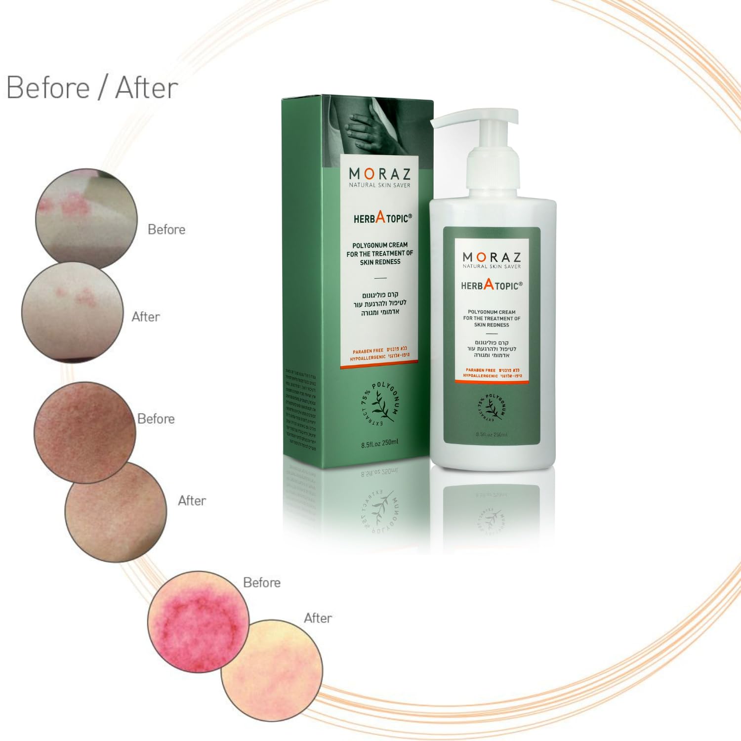 Moraz Herb-A-Topic Polygonum Cream for the Treatment of Skin Rashes, 250 ml