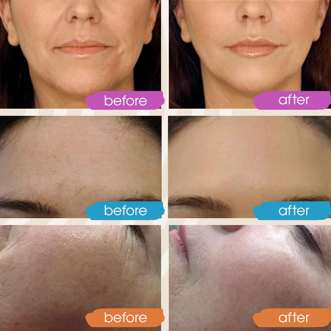 GLEOW Retinol Serum for Face, Vitamin C with Hyaluronic Acid Face Serum for Women and Men, Glow Skin Care Set Targets Appearance of Uneven Skin Tone and Dryness 3x1oz