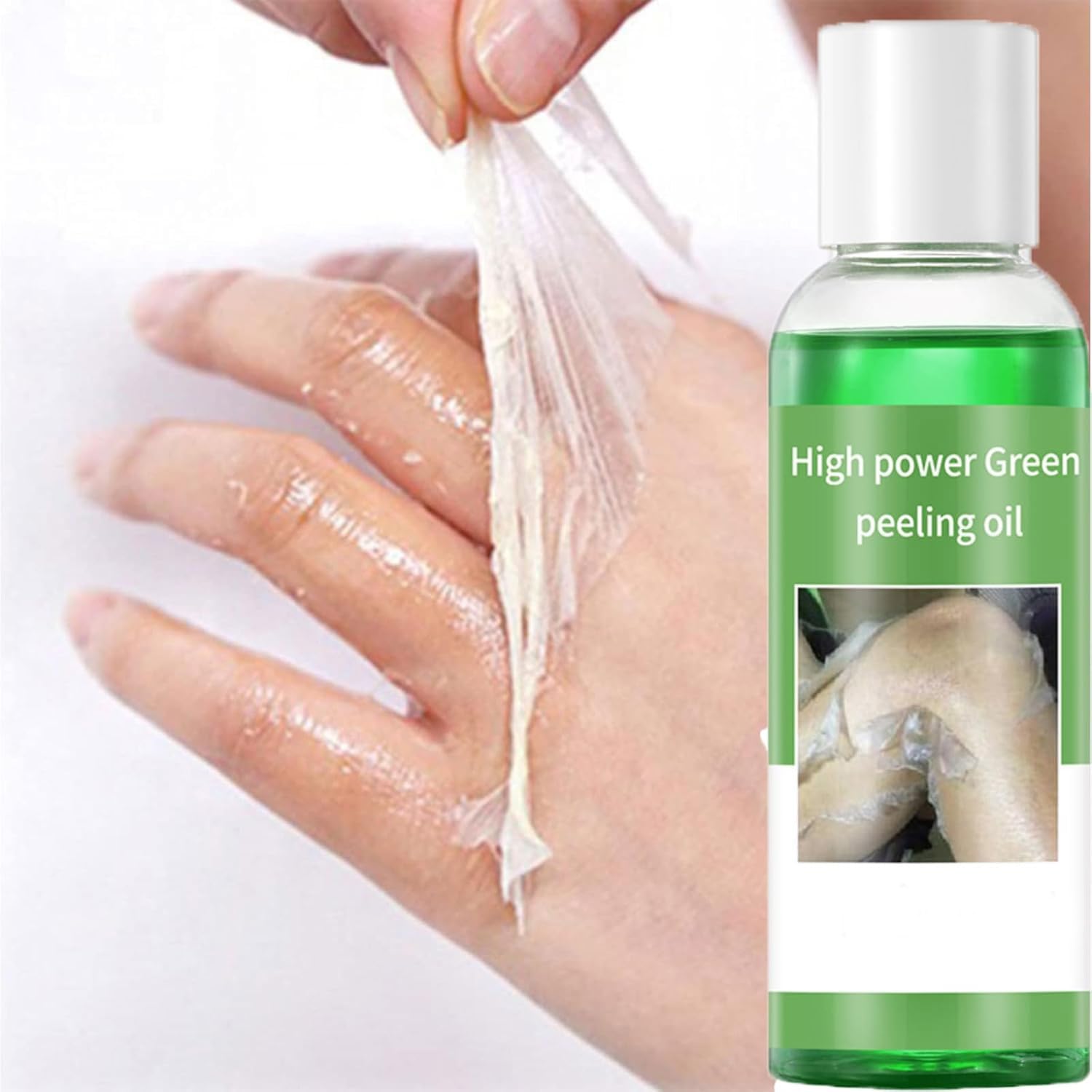 Generic Peeling Oil for Dark Skin, Green Peeling Oil Extra Strength, Extra Strong Peeling Oil for Hand, Feet and All Body, Chemical Peel for Face at Home,110ML/3.88Oz (1 PCS)