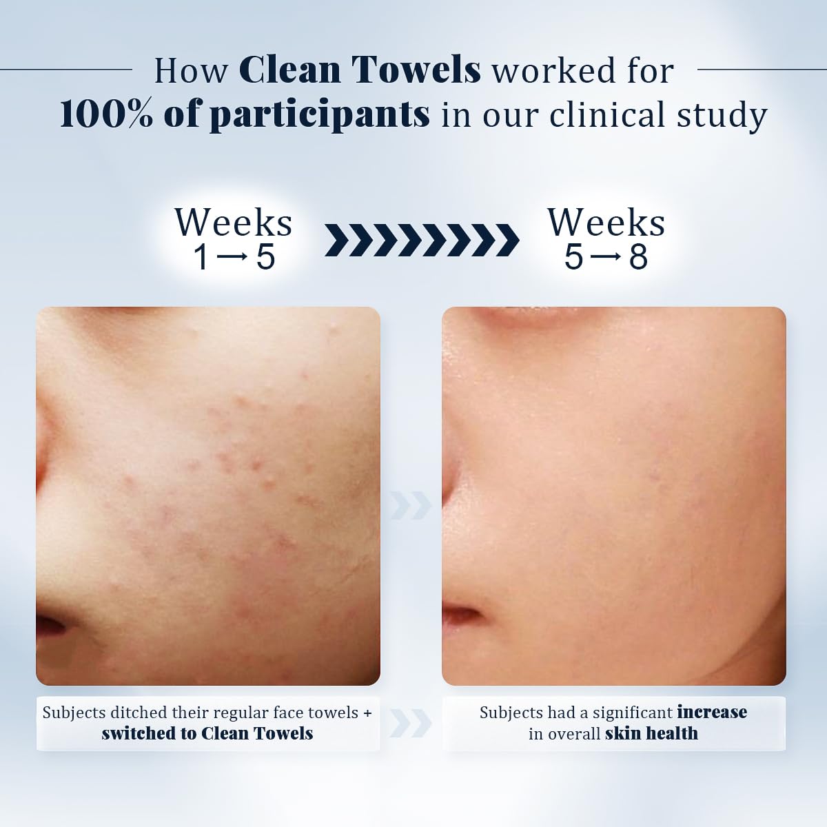 DewVera Disposable Face Towel, 10×12 Ultra Soft Thick Face Wipes Paper Towels, Lint-Free Single Use Washcloth Makeup Remover Dry Wipes Towelette Face Cloth For Sensitive Skin Cleaning, 50 Ct 1 Pack