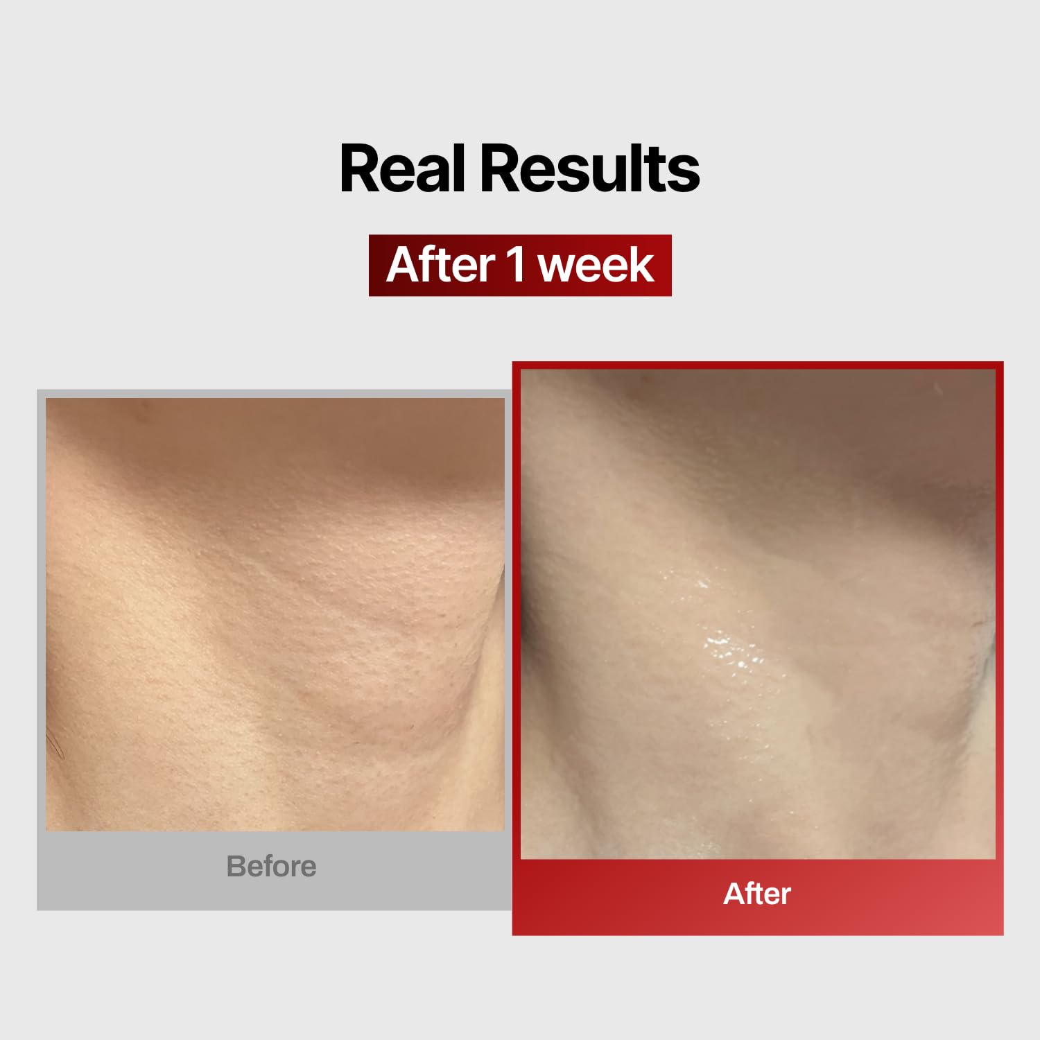 Wrinkle-fit Neck Mask - Neck Wrinkle Patches, Neck Firming and Tightening Korean Deep Collagen Mask - Hyaluronic Acid Neck-Targeted Mesh Sheet Mask for Lifting Sagging Skin - Boosting Elasticity 7EA