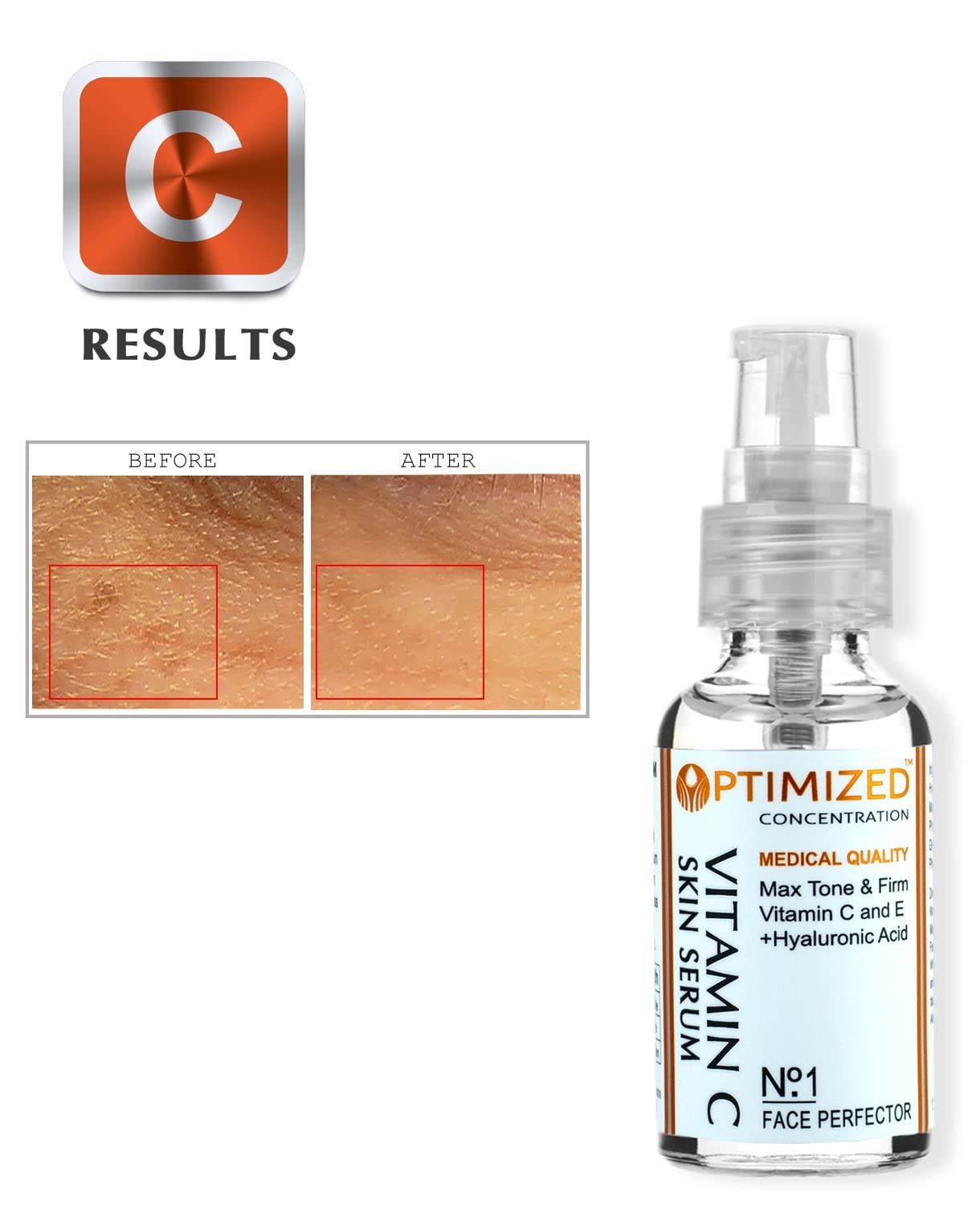 OPTIMIZED Best Medical Grade Skin Care Anti Aging Vitamin C Serum with Vitamin E and Hyaluronic Acid for Face, Fill Fine Lines, Fades Age Spots, Evens Skin Tone, Anti Wrinkle