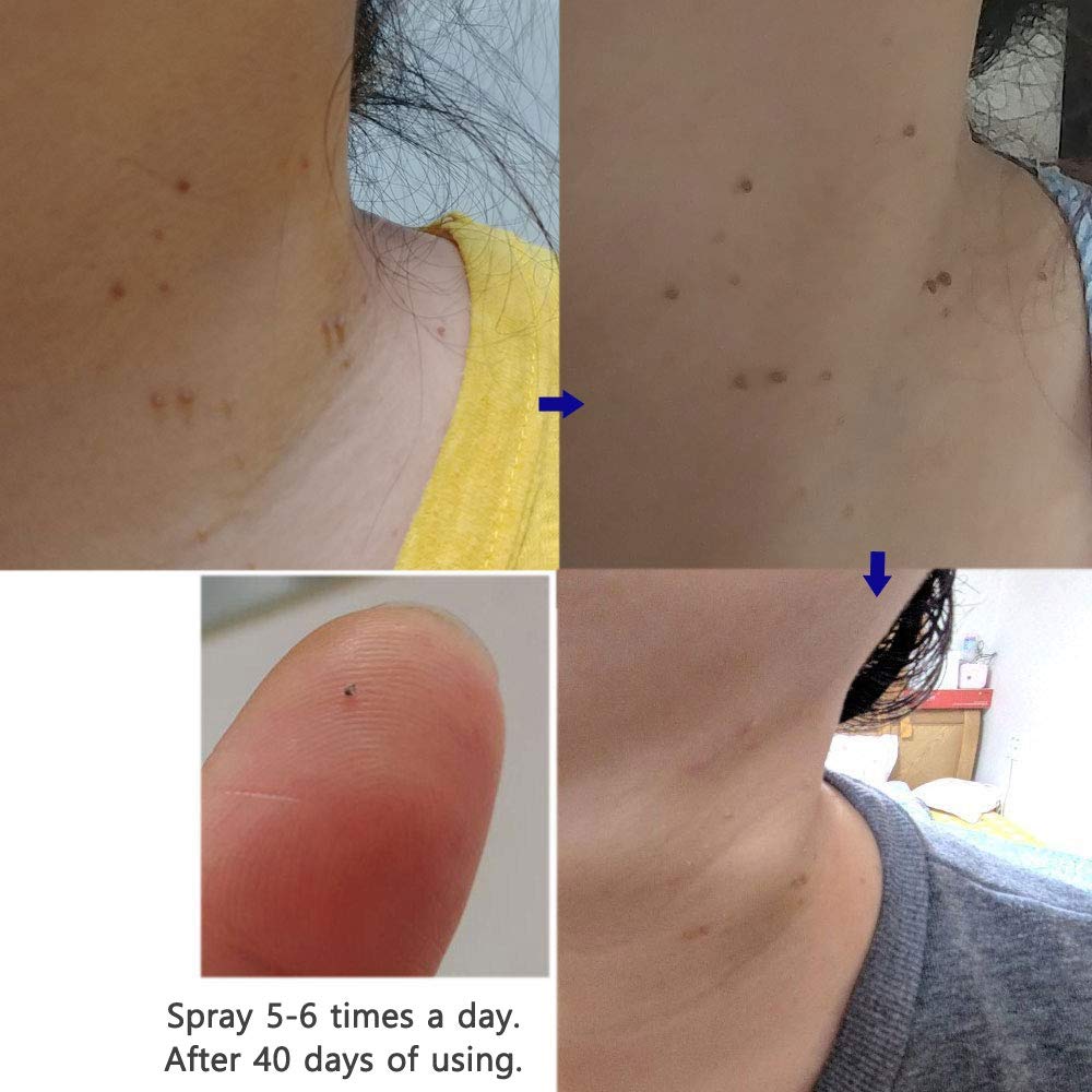 Dr.Deep Skin Toner with Natural Mineral Deep Moisturizing, Hydrating Toner