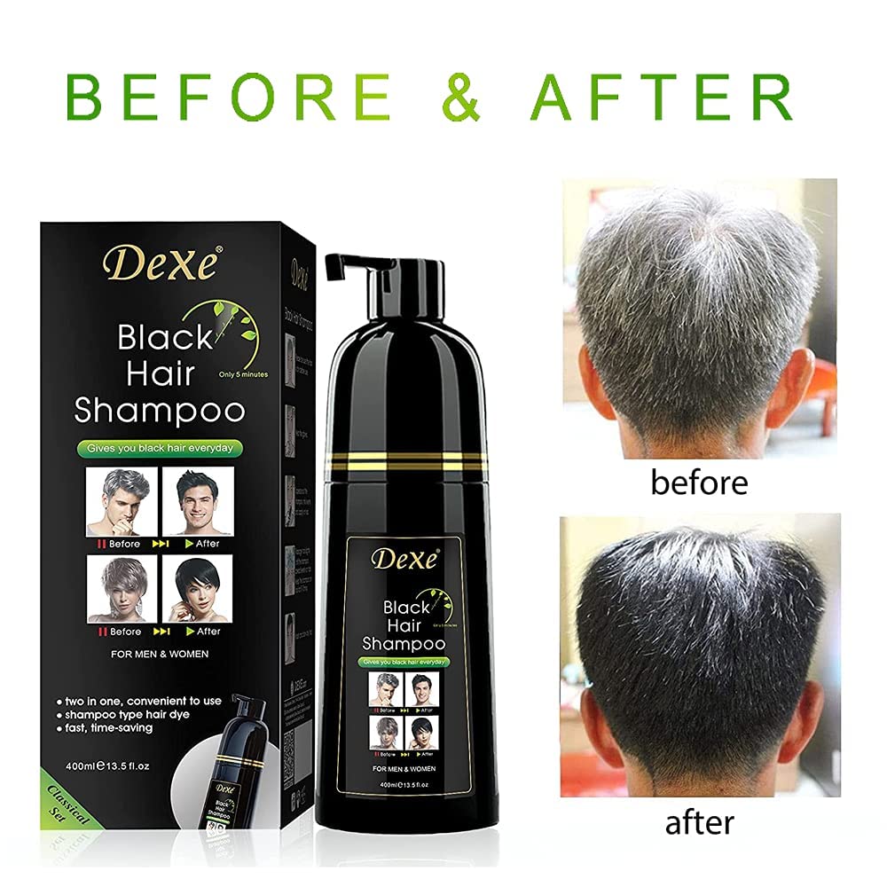 Dexe Hair Dye Shampoo 14.1 Fl Oz, Gray Hair Coverage, Black Hair Dye, Hair Color Shampoo, Black Hair Shampoo for Men & Women