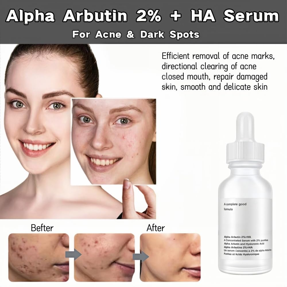 Alpha Arbutin 2% + Hyaluronic Acid Serum, Alpha Arbutin 2% Ha Face Serum For Fine Lines & WrinkleAnd Acne,Women Moisturizing Hyaluronic Acid Serum .30 ML