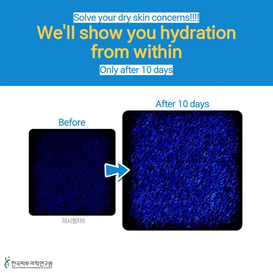 LE PURS AMIS Organic Shea Butter Moisturizing Lip balm, Multi-purpose, Nourishing, Hydrating, Chemical-free, Non-toxic, Shea butter Scent (10, Grams), Dry Skin, Dryness, Korean