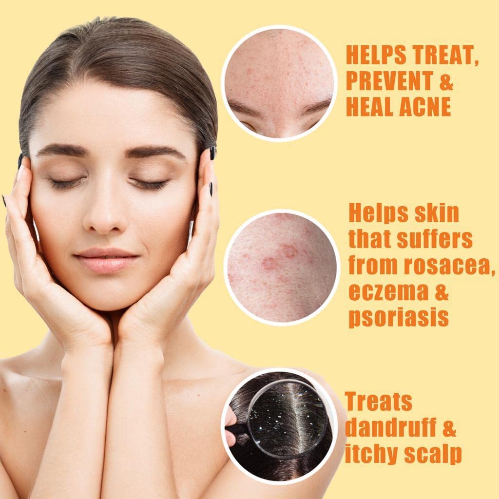 10% Sulfur Soap Cleansing Bar for Face & Body – All Natural Sulfur Facial Cleanser for Acne, Oily Skin – Skincare Blend of Lemongrass, Tea Tree Essential Oil, Vitamin E, Coconut Milk – Made in USA