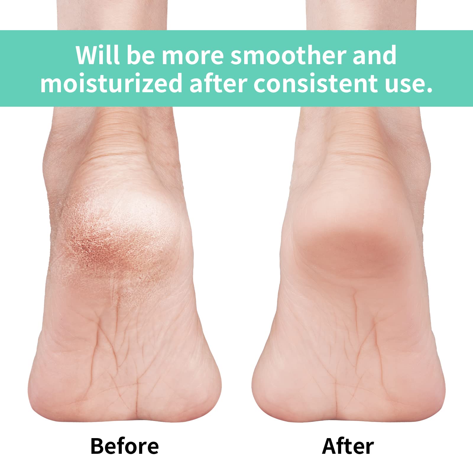 Vaincre Gel Moisturizing Heel Socks for Dry Cracked Feet Women, 4 Pairs Foot Care Spa Moisture Toeless Socks for Cracked Heel Repair Treatment Overnight (Regular)