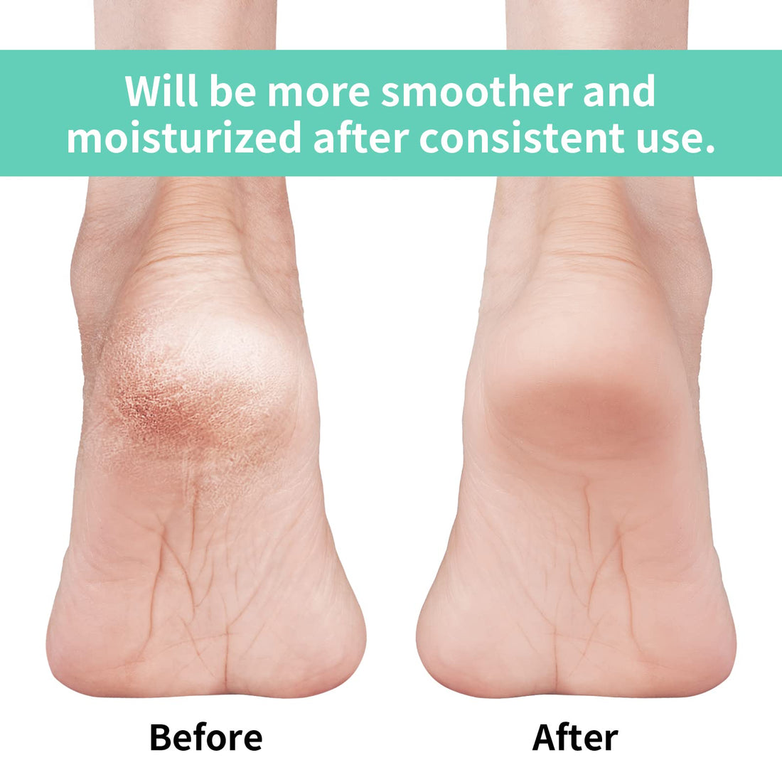 Vaincre Gel Moisturizing Heel Socks for Dry Cracked Feet Women, 4 Pairs Foot Care Spa Moisture Toeless Socks for Cracked Heel Repair Treatment Overnight (Regular)