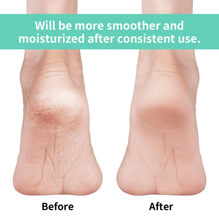 Vaincre Gel Moisturizing Heel Socks for Dry Cracked Feet Women, 4 Pairs Foot Care Spa Moisture Toeless Socks for Cracked Heel Repair Treatment Overnight (Regular)