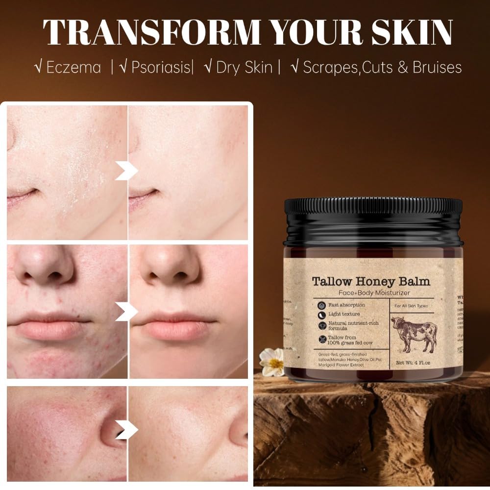 GAHQB Beef Tallow Honey Balm for Skin : Grass-Fed Beef Tallow Moisturizer For Face and Body, Tallow Cream with Manuka Honey Beeswax Olive Oil, 4 oz