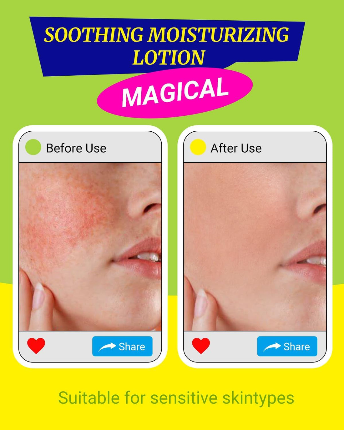 larosanna Travel Size Moisturizing Lotion for Sensitive Skin Made in Australia,Skin Care Ideal for Redness and Dryness Relief,Face Moisturizer with Gentian Root Extract,0.35 fl oz