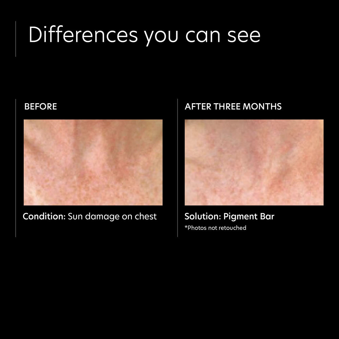 PCA SKIN Pigment Bar, 3.4 fl. oz.