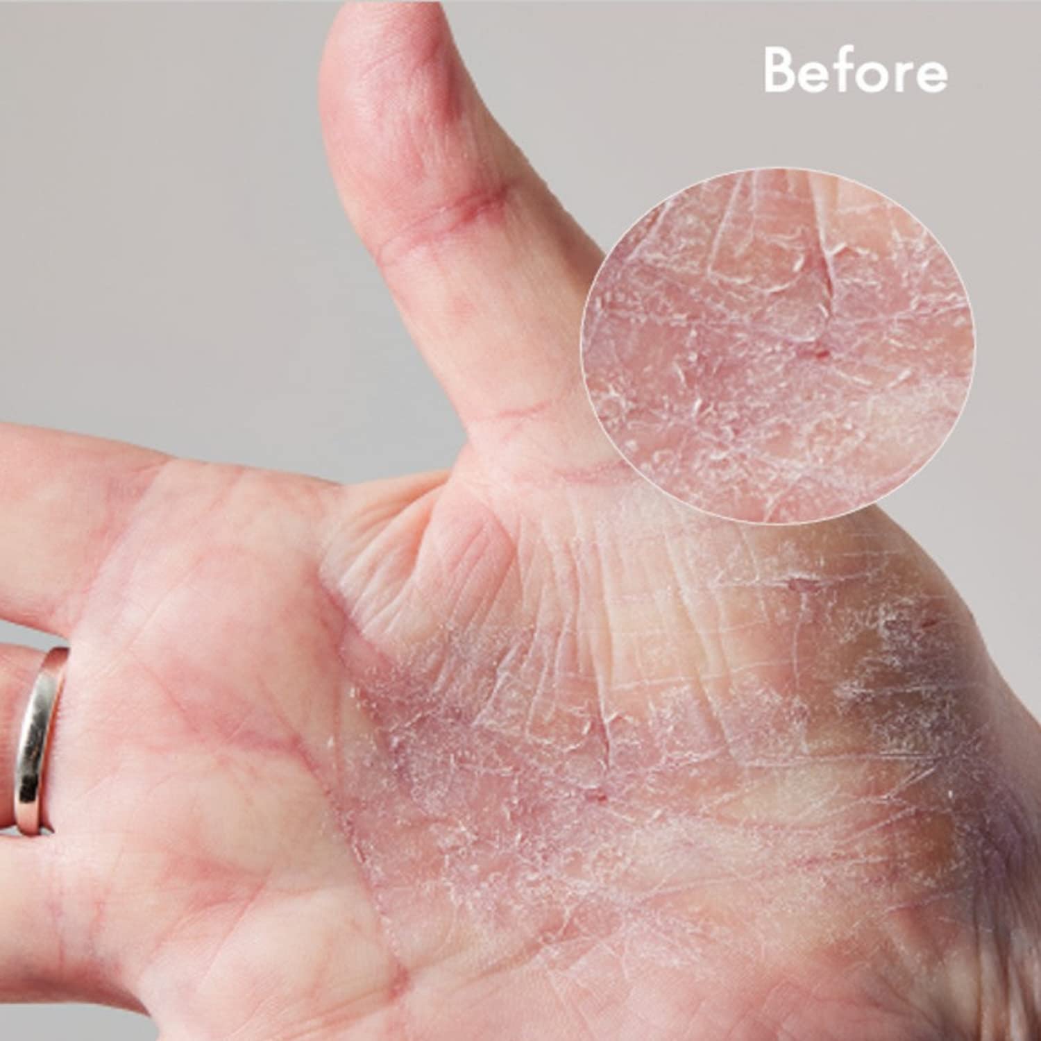 Lanolips 101 Dry Skin Super Cream - Body Cream & Face Moisturizer - Whipped Body Butter for Dry Skin - Triple Lanolin, Sweet Almond Oil, Shea Butter & Vitamin E Infused Body Care (2.02 oz)