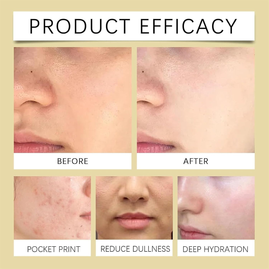 Ecdoin Anti-Aging Essence, Nuosili Face Lift Spray, Ecdoin Anti Wrinkle Serum, Tighten and Reduce Wrinkles, Anti-Wrinkle Lifting Firm Toner Water, Moisturizes for Mature and Dry Skin (2)