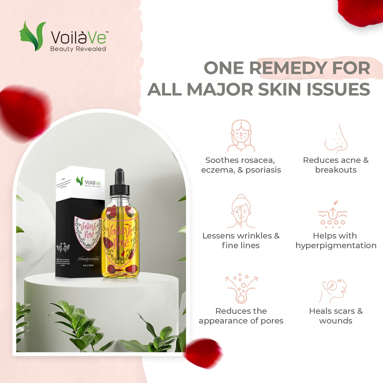 VoilaVe Rose Oil, Blend of Organic and Natural Oils for Face, Hair, and Body, No Artificial Ingredients, Pure and Natural Treatment for Wrinkles, Scars, Sunburn, Acne, and Dry Skin, 4 fl oz.