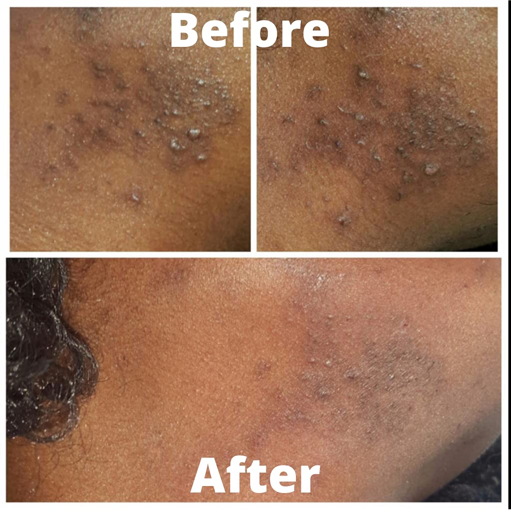 Fair & White Savon Gommant Exfoliating Soap #64533