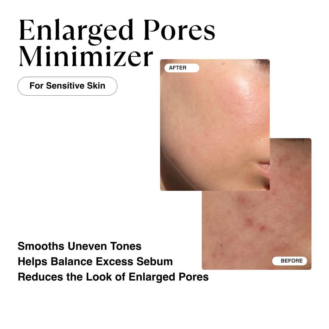 MATKAS Korean Hydration Boost Antioxidant Serum for Face 1 Fl. Oz, Gentle 2% Pure Niacinamide Serum Korean Skincare, Hyaluronic Acid and Niacinamide Pore Minimizer Treatment for Oily Skin, Dark Spots