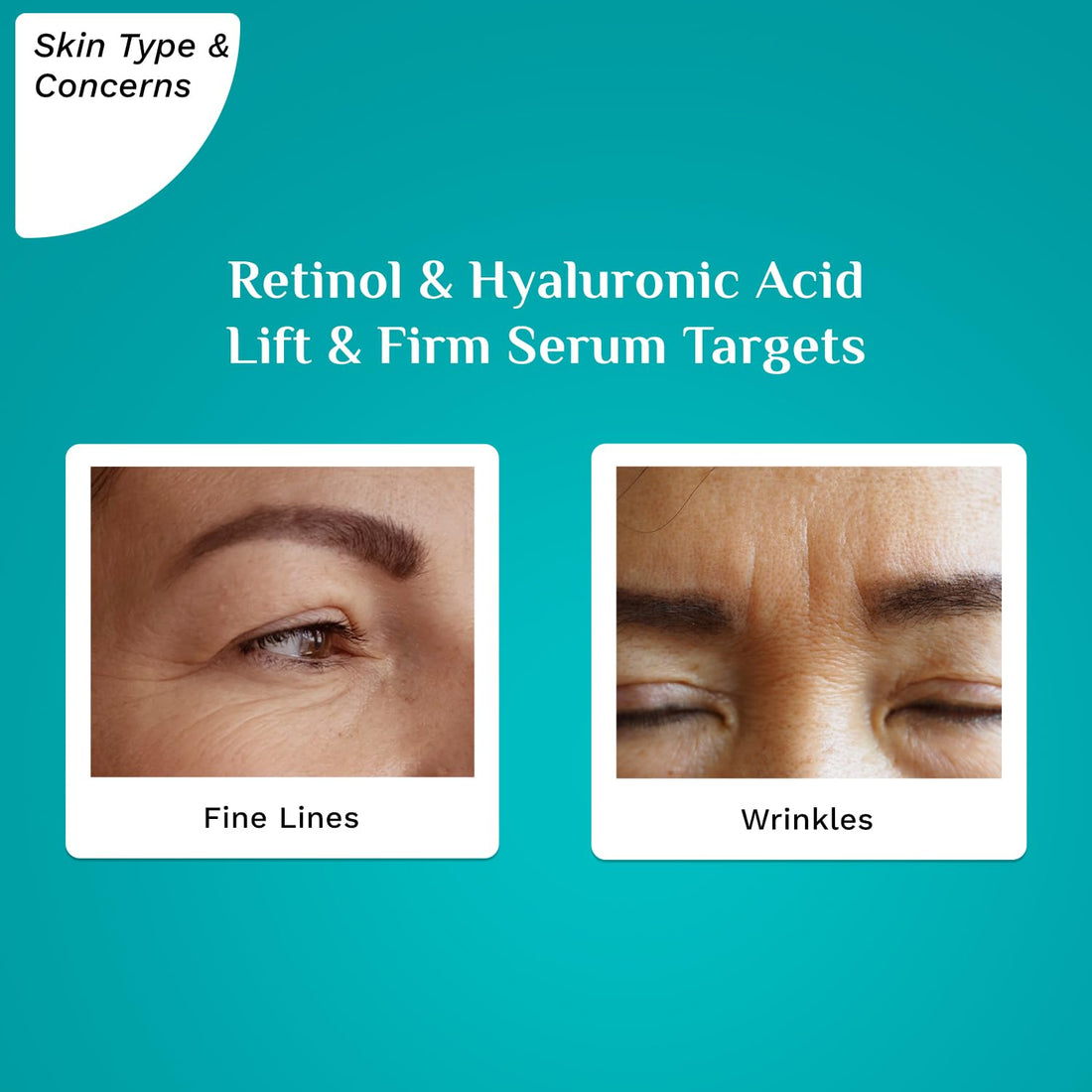 Pilgrim Lift & Firm Face Serum | Retinol & Hyaluronic Acid Anti Aging Serum | Firms Skin, Smooths Fine Lines, Restores Elasticity & Radiance | Lightweight & Fast Absorbing | 1.01 Fl Oz (30ml)