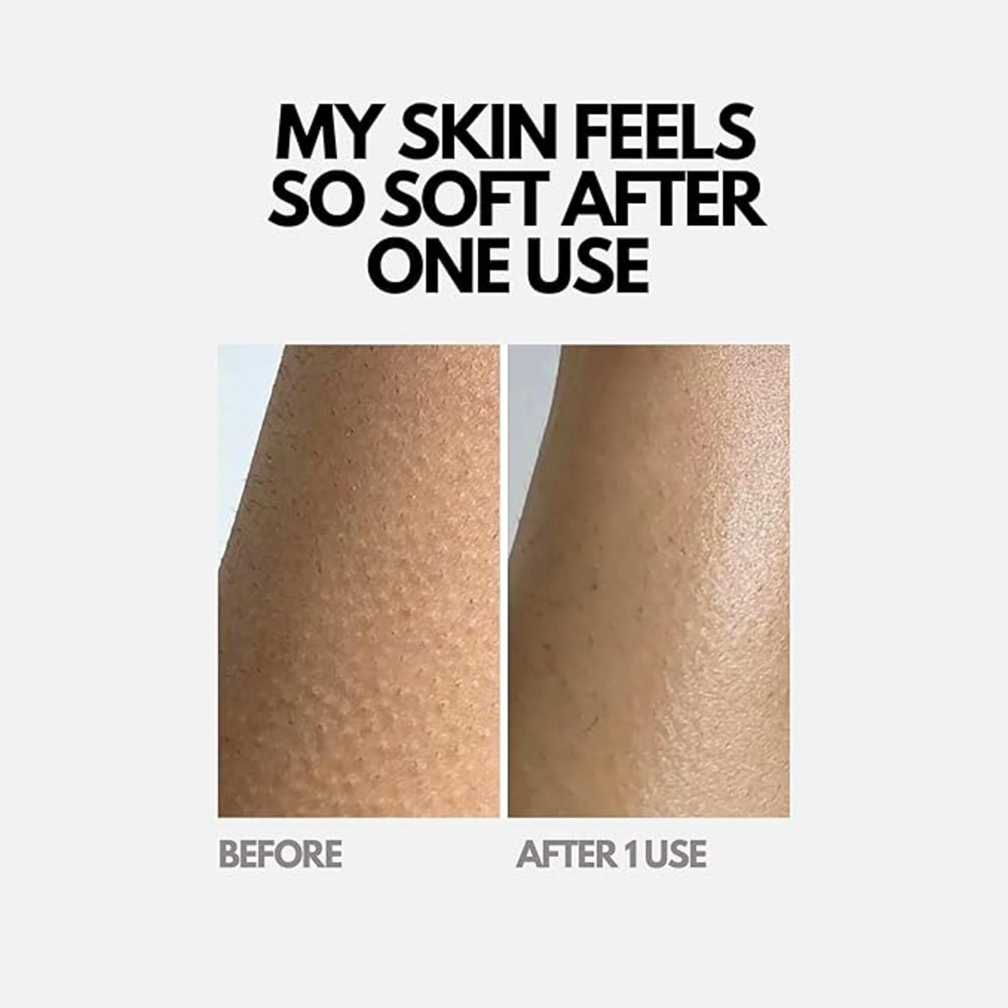 Dylonic Exfoliating Brush For Razor Bumps and Ingrown Hair Treatment, Silicone Face Scrubbers, Face and Body Exfoliator Set - Perfect for Dry Brushing, Body Brush by Dylonic