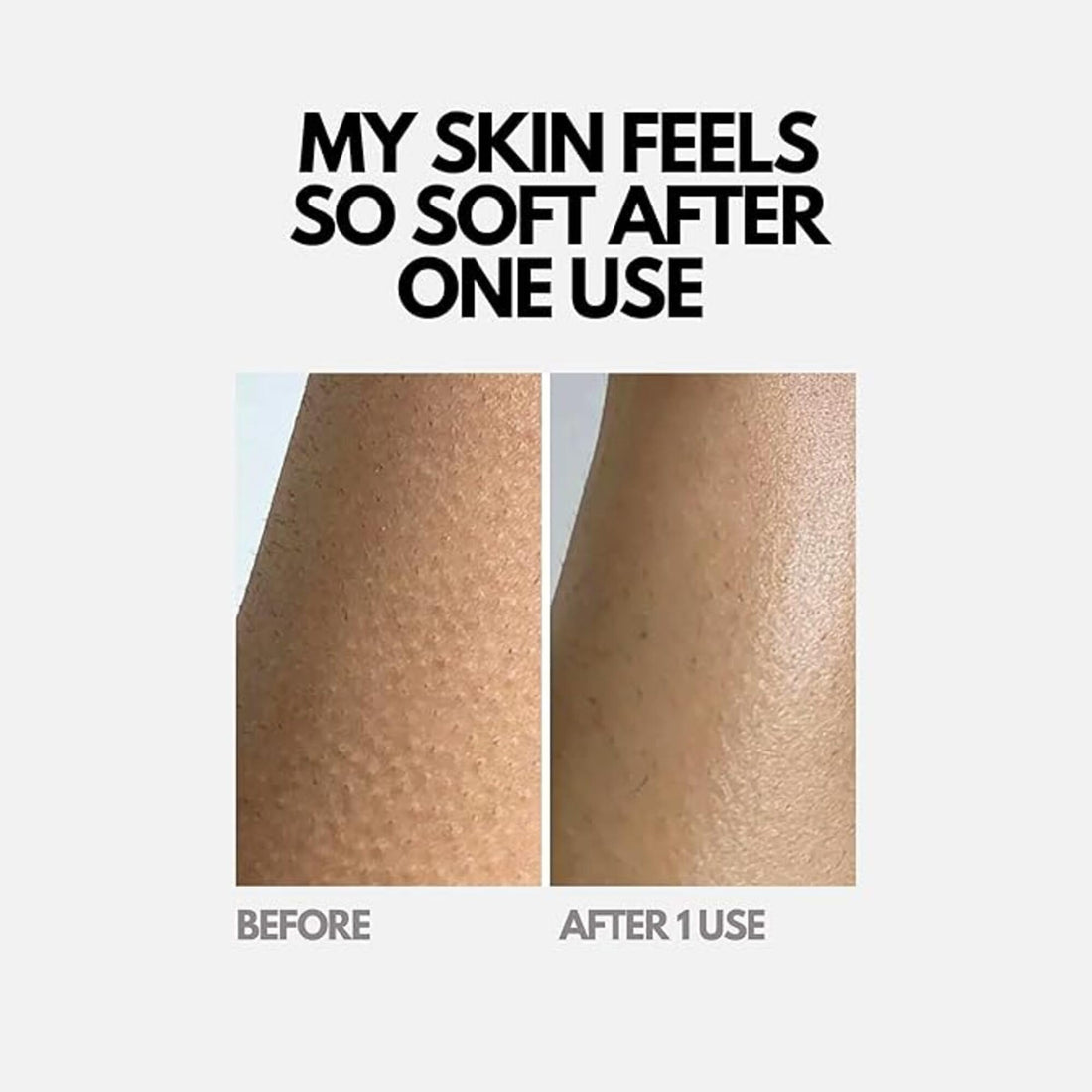 Dylonic Exfoliating Brush For Razor Bumps and Ingrown Hair Treatment, Silicone Face Scrubbers, Face and Body Exfoliator Set - Perfect for Dry Brushing, Body Brush by Dylonic