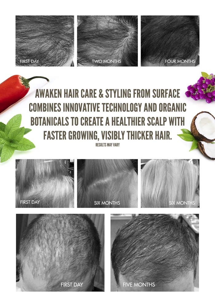 Surface Hair Awaken Scalp Elixir, 4 Fl Oz