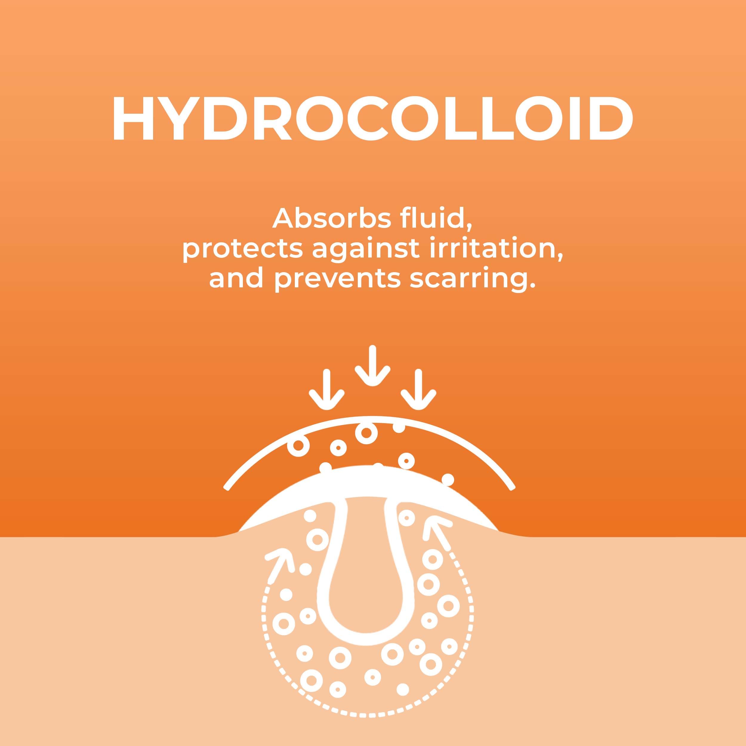 PatchRx Acne Patches (120 Count) with Hydrocolloid Only, Hydrocolloid Pimple Patches for Face - Zit Patch Acne Dots - Acne Patches - Pimple Patch with 3 Size Acne Stickers