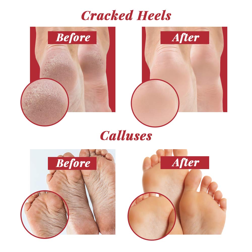 Checi Foot File Carded Nail Files, Dual Coarse and Medium