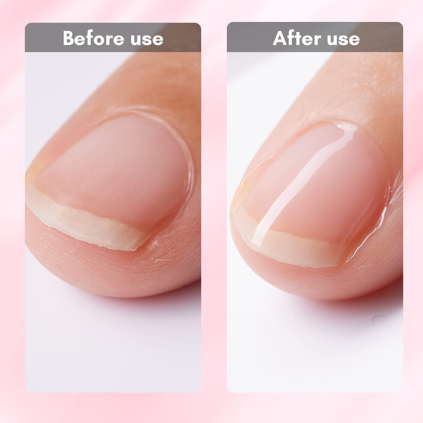 Makartt Gel Nail Strengthener Reinforce Polish, Nail Strengthening Repair Polish for Treating Weak, Damaged Nails, Clear Soak Off Gel Lacquer Long Lasting Professional DIY Nail Art, P-44