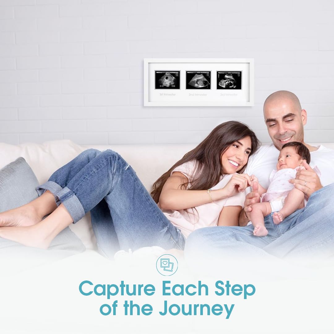 Pearhead Sonogram Progression Frame - Trimester by Trimester Pregnancy Milestone Keepsake, Gender-Neutral Nursery Decor, Displays 1st, 2nd & 3rd Trimester Ultrasound Photos, White