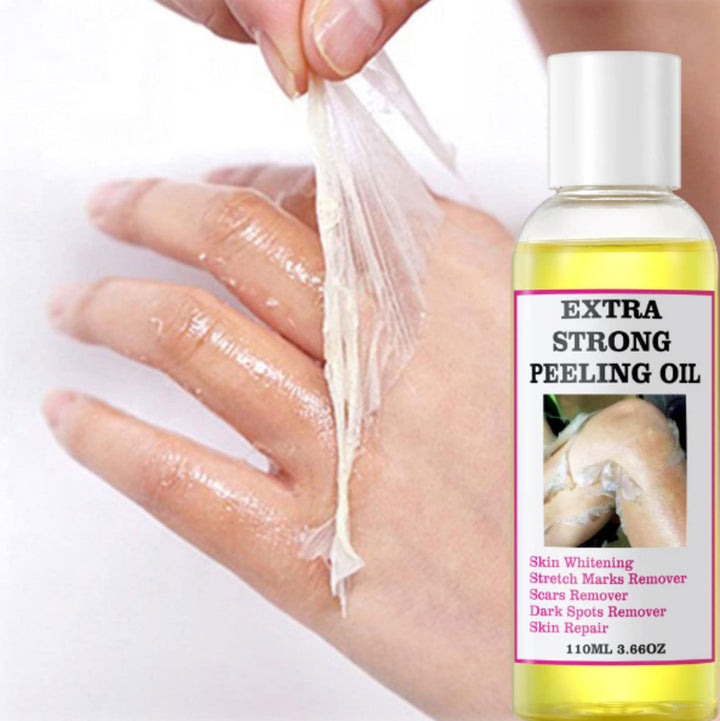 Yellow Peeling Oil - Strong Extra Strength Exfoliating Solution for All Skin Types - Dead Skin Remover (110ML/3.88 OZ)