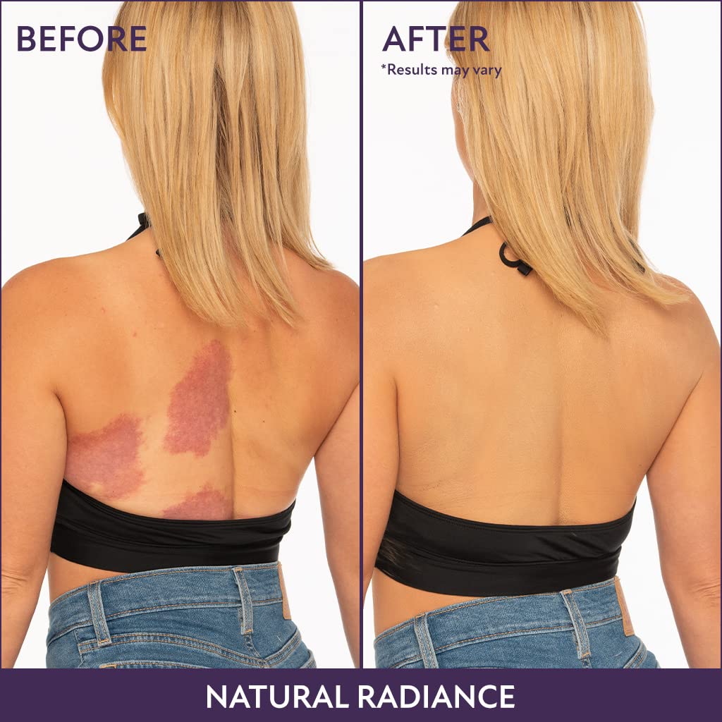 Westmore Beauty Body Coverage Perfector, Golden Radiance Shade, 7 Oz