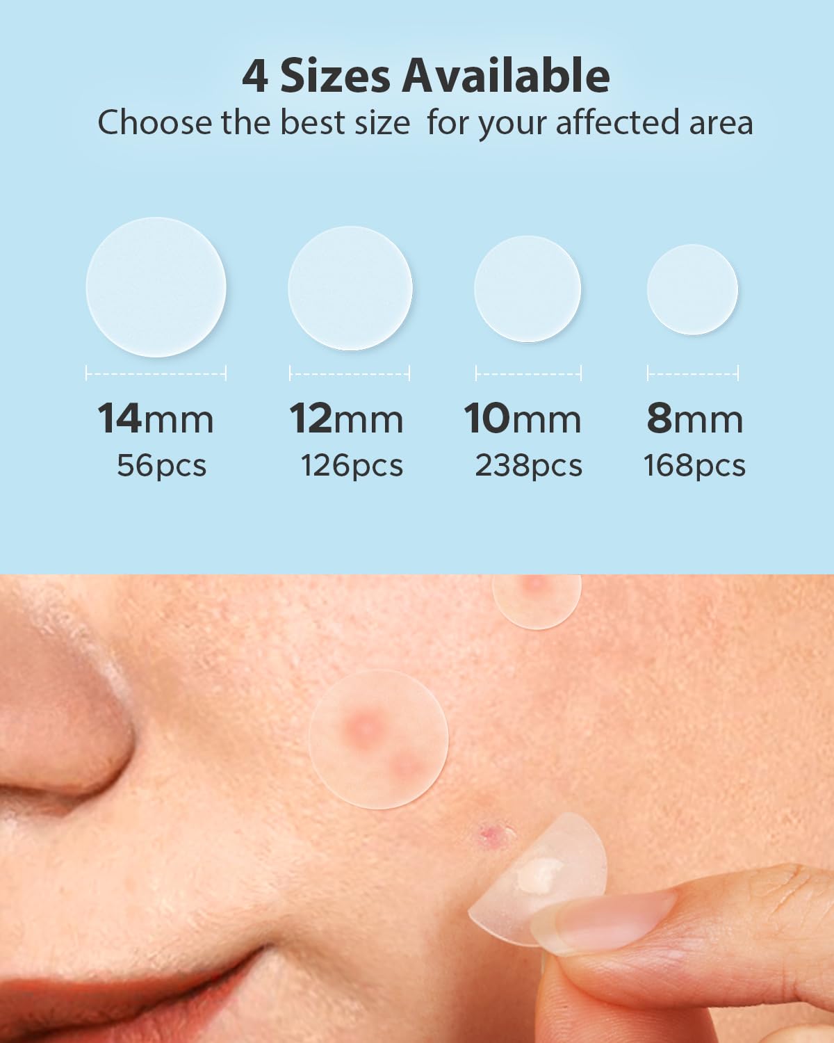 LitBear Acne Pimple Patches- Day and Night 4 Sizes 588 Dots Thin & Thick Hydrocolloid Patches with Witch Hazel, Tea Tree & Calendula Oil, Extra Adhesion for Face Zit Patch Dots