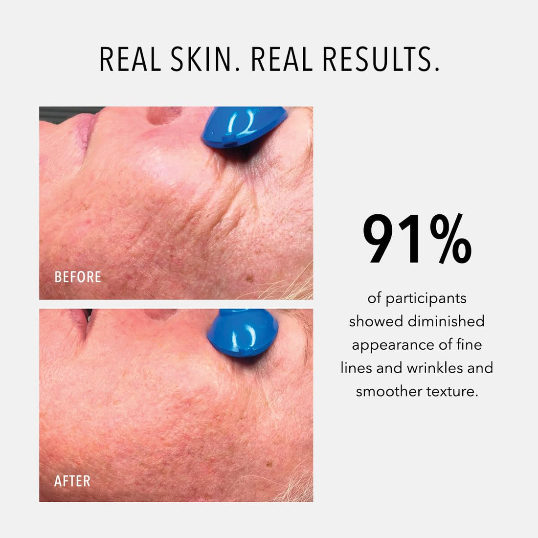 HydroPeptide Nimni Cream, Patented 0.25% Retinol Collagen Support Complex, Enhance Appearance of Healthy Skin, 1.7 Ounce