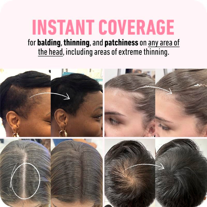 Boldify Hairline Powder + Shampoo: Bundle: Root Touchup Hair Loss Powder and Natural Volumizing Shampoo for Fine Hair (Dark Brown)