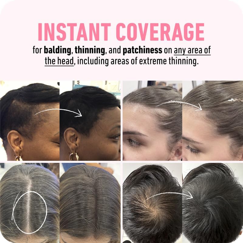 BOLDIFY Hairline Powder - Root Touch Up Hair Color for Gray Coverage - Bald Spot Concealing Hair Powder for Women & Men - 48-Hour Stain-Proof - Medium Brown