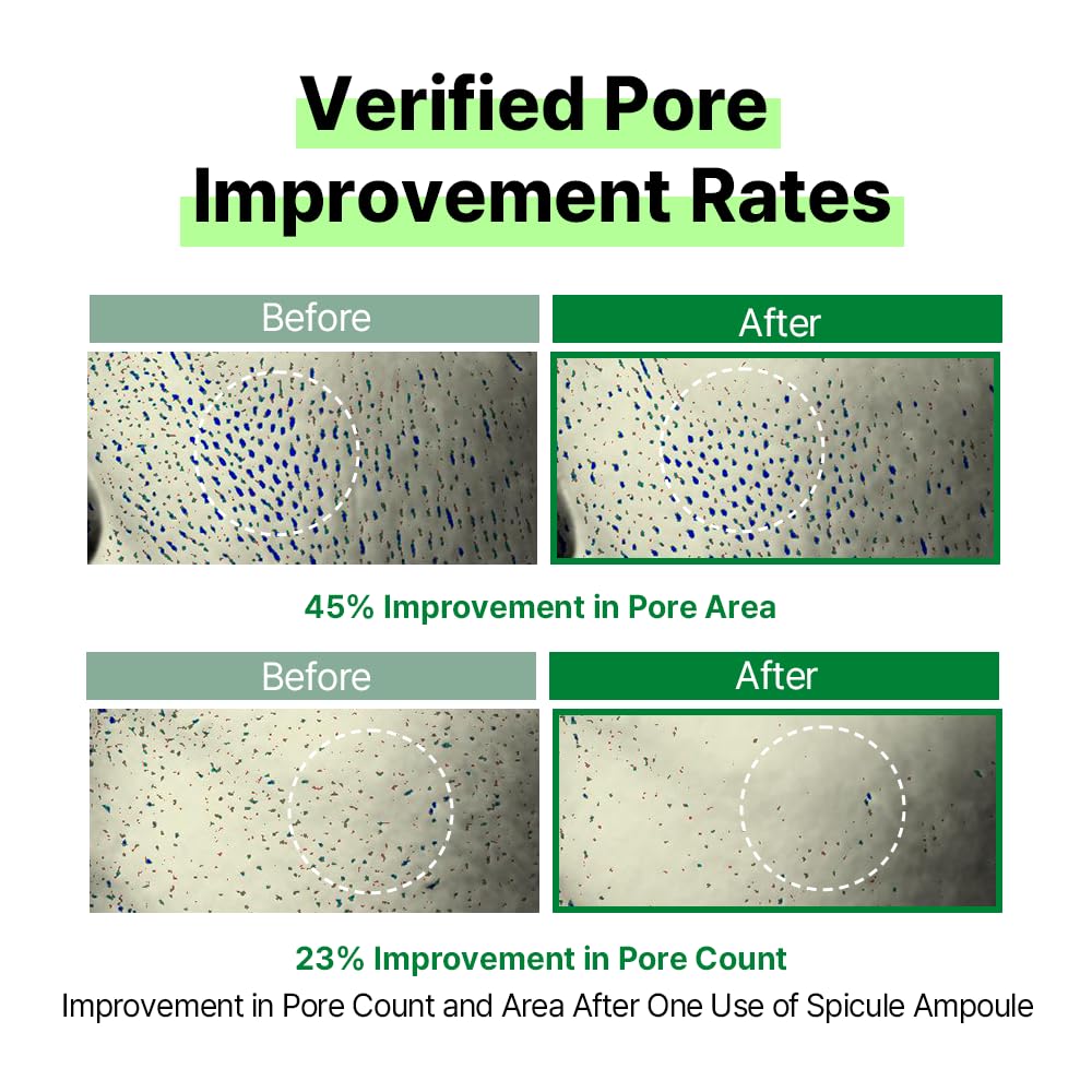 AVCA Micro Fit Shot Spicule 100 Ampoule serum - Korean Skin Care, Hyaluronic Acid, Daily Face Essence for Soft Skin, (50ml/1.69fl.oz.)