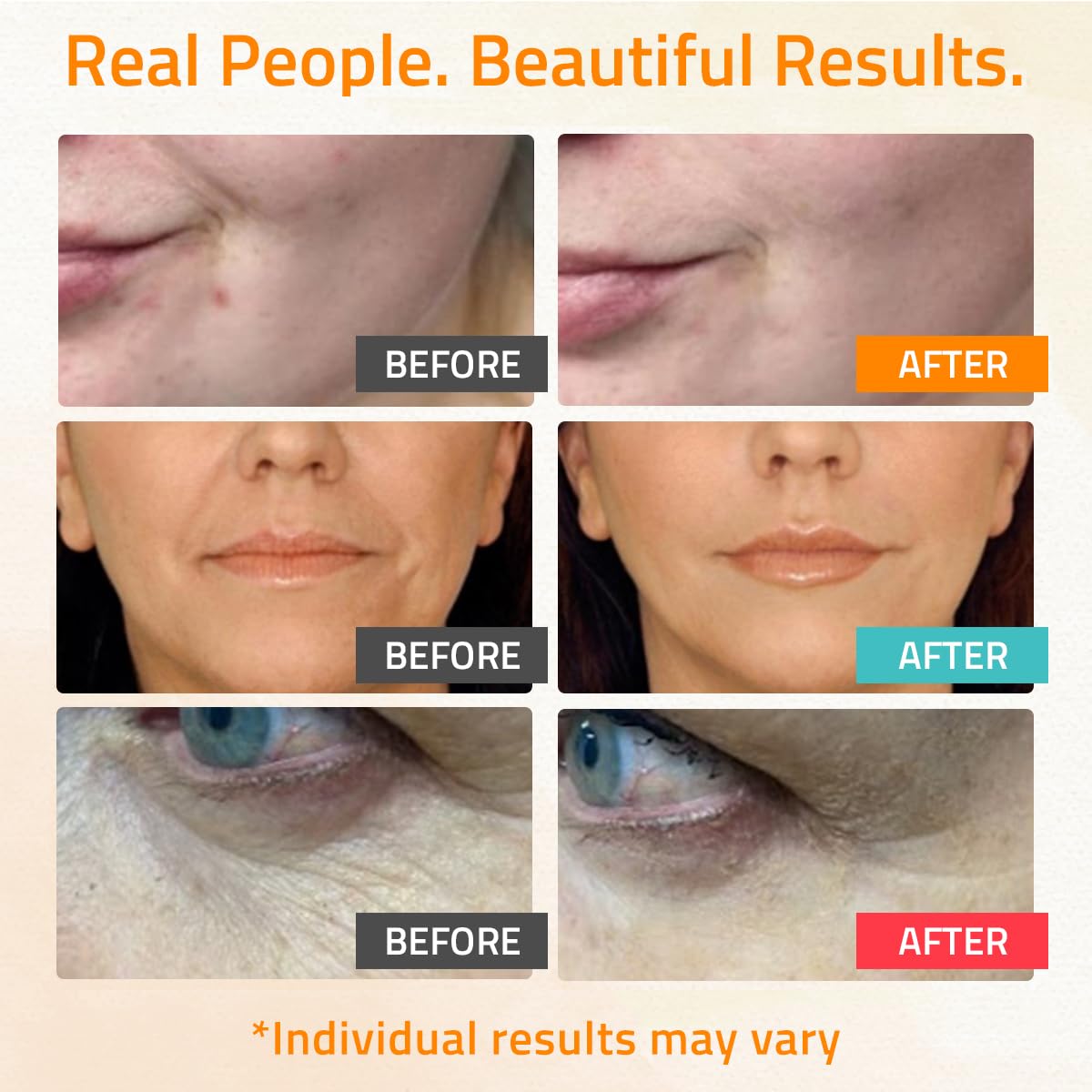 YEOUTH Skin Care Set: Hyaluronic Acid Serum for Face, Retinol Serum for Face and Vitamin C, Skincare Set Targets Appearance of Uneven Skin Tone and Dryness 3x1 oz