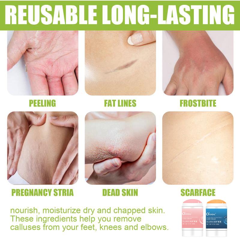 O'CHEAL Anti-Drying Crack Foot Cream Hand Cracked Repair Cream Body Cream Cracked Feet Removal Dead Skin Hand Feet Care Skin